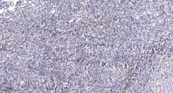 Ribosomal Protein S11 rabbit pAb