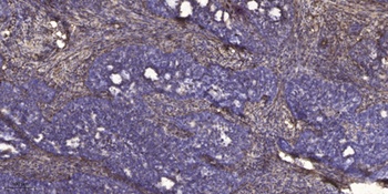 Ribosomal Protein S18 rabbit pAb