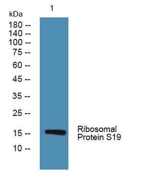 Ribosomal Protein S19 rabbit pAb