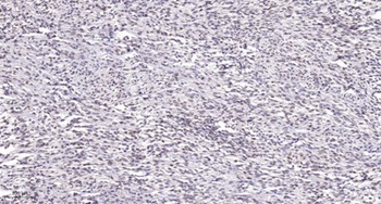 Ribosomal Protein S19 rabbit pAb