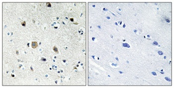 Ribosomal Protein S20 rabbit pAb