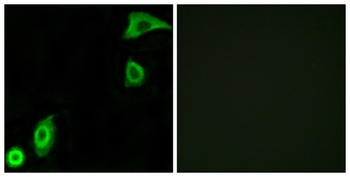 Ribosomal Protein S20 antibody