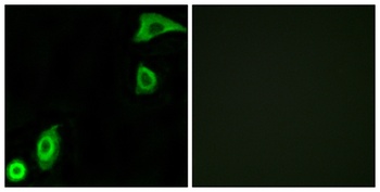 Ribosomal Protein S20 rabbit pAb