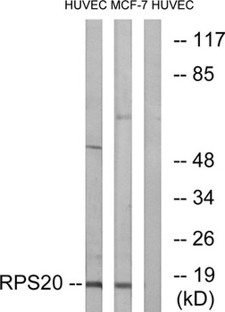 Ribosomal Protein S20 rabbit pAb