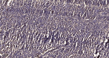 Ribosomal Protein S23 rabbit pAb