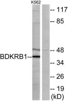 Bradykinin B1 R rabbit pAb