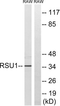 Rsu-1 rabbit pAb Antibody