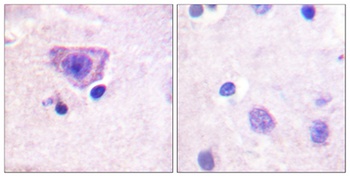 RyR-2 (phospho Ser2808) rabbit pAb