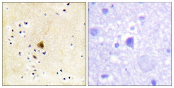 RyR-2 rabbit pAb