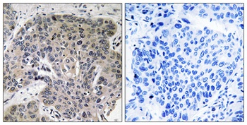 S-100A3 rabbit pAb Antibody