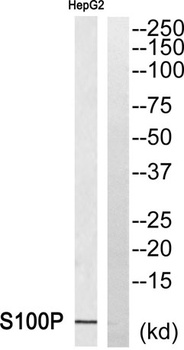 S-100P rabbit pAb Antibody
