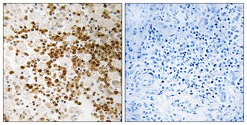 S-100P rabbit pAb Antibody