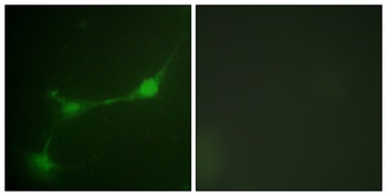 Ataxin-1 (phospho Ser776) rabbit pAb