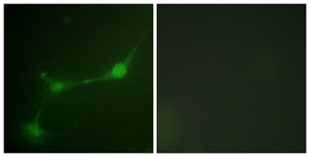 Ataxin-1 (phospho-Ser776) antibody