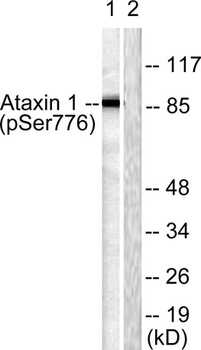 Ataxin-1 (phospho-Ser776) antibody