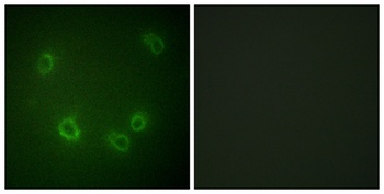 ENaC β (phospho Thr615) rabbit pAb
