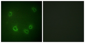 ENaC beta (phospho-Thr615) antibody