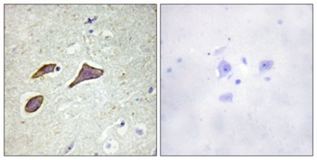 ENaC β (phospho Thr615) rabbit pAb