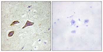 ENaC beta (phospho-Thr615) antibody