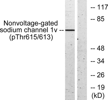 ENaC beta (phospho-Thr615) antibody