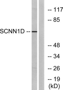 ENaC delta antibody