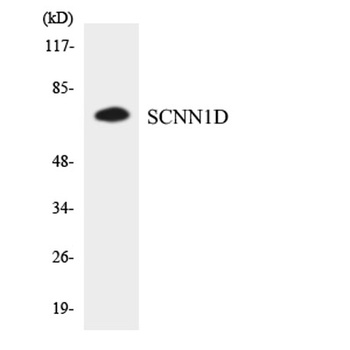 ENaC delta antibody