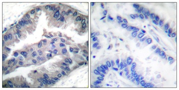 NBK (phospho Thr33) rabbit pAb