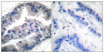 NBK (phospho-Thr33) antibody