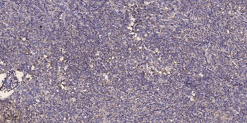 Serine racemase rabbit pAb Antibody