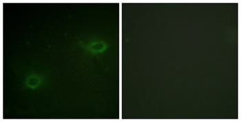 Syndecan-4 antibody