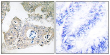 CIDE-3 antibody