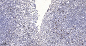 RBM26 rabbit pAb