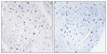 BLM (phospho Thr99) rabbit pAb Antibody