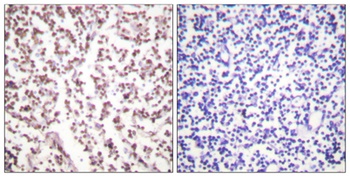 BLM antibody