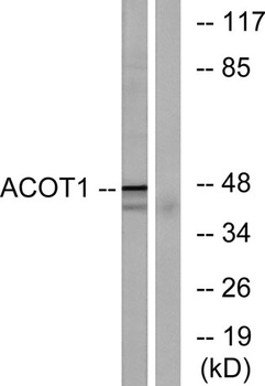 ACOT1 rabbit pAb