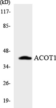 ACOT1 rabbit pAb