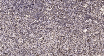 SRp40 rabbit pAb