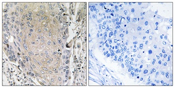 Cerebellin 3 rabbit pAb Antibody