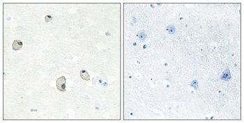 Cadherin-22 rabbit pAb