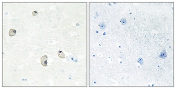 Cadherin-22 antibody