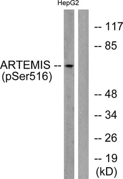 Artemis (phospho-Ser516) antibody