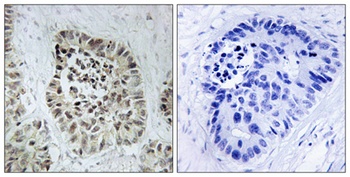 Artemis antibody