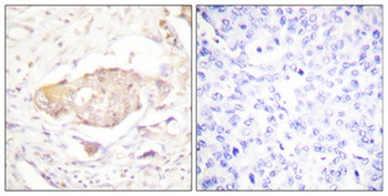 SGK1 (phospho Ser422) rabbit pAb