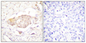 SGK1 (phospho-Ser422) antibody