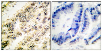 SGK1 (phospho Ser422) rabbit pAb