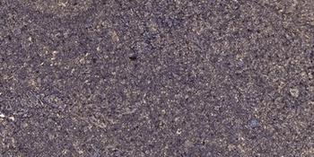 SGK1 (phospho Ser78) rabbit pAb