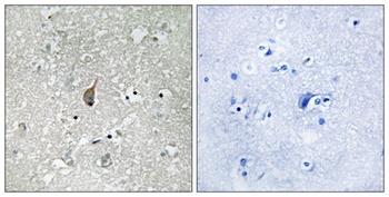 APC1 (phospho Ser355) rabbit pAb