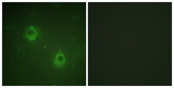 APC1 (phospho Ser688) rabbit pAb