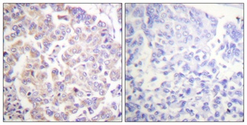 APC1 (phospho-Ser688) antibody