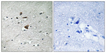 APC1 rabbit pAb Antibody